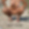 [PHD] 2024-07/30 Anneth - Sunstroke